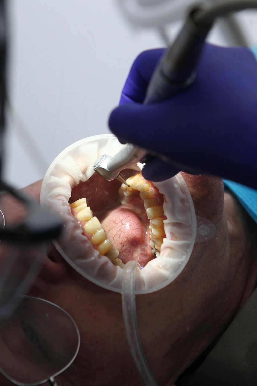 Dental hygiene excellence